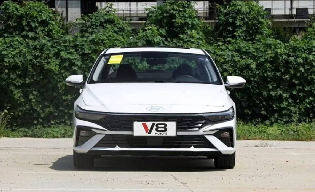 2025 Hyundai Elantra SMART thumbnail 2